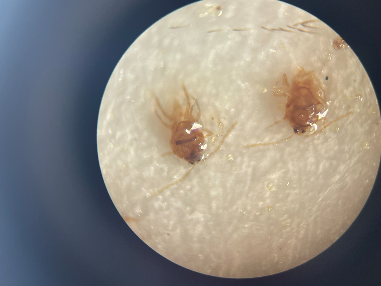 San Jose Scale in Pulaski County Microscope picture of San Jose Scale in Pulaski County