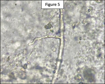 Microsopic view of brown patch on tall fescue.