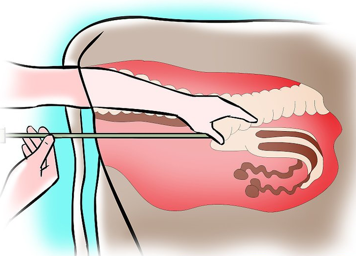 artificial insemination of a cow on an illustration