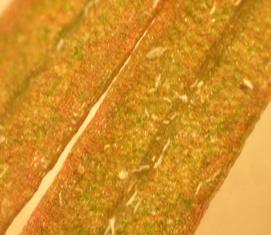 Image shows microscopic view of rust mite on a baldcypress leaf.